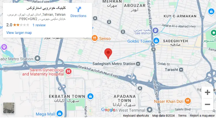 جلوبندی سازی استارلوکس در غرب تهران